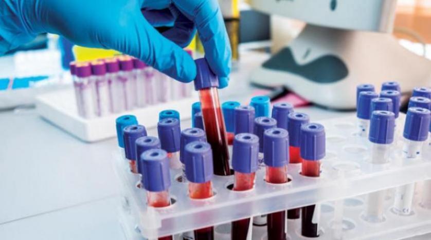 اختبار دم جديد يكتشف السرطانات بين الأشخاص قبل ظهور أي أعراض  